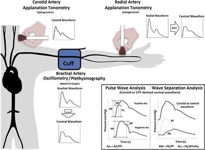 Central Pressure Waveform-Derived Indexes Obtained From Carotid and Radial Tonometry and Brachial Oscillometry in Healthy Subjects (2–84 Y): Age-, Height-, and Sex-Related Profiles and Analysis of Indexes Agreement